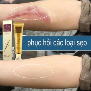 Kem Mờ Sẹo Mờ Thâm Peimei - Kem Giảm Sẹo Và Rạn Da - Chống Sẹo Lồi Sẹo Lõm Hiệu Quả Sau 1 Tuần 30gr