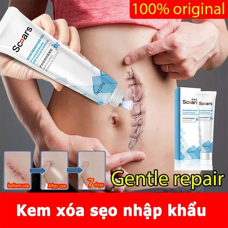 Kem trị sẹo Kem xóa sẹo/loại bỏ hiệu quả các vết sẹo lâu năm/sẹo phẫu thuật/Vết rạn da,xóa vết bỏng/ vết cắn