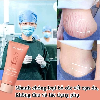 kem rạn da kem rạn da cho bà bầu 50g kem trị rạn da trị rạn da bà bầu kem trị rạn da cho bà bầu mờ sẹo