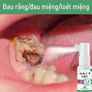 Xịt sâu răng Chai xịt sâu răng ĐAU RĂNG,VỆ SINH RĂNG MIỆNG tác dụng nhanh tại vị trí đau sâu răng 20ml