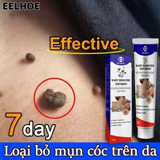 Thuốc trị mụn cóc thuốc bôi mụn cóc 20g kem trị mụn cóc thuốc chấm mụn cóc thuốc bôi mụn cóctẩy mụn cóc