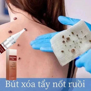 Bút Xóa Mụn Cóc Liệu Wart Removal Cream Kem mụn cóc 20g loại bỏ  mụn cóc tẩy nốt ruồi mụn cóc phục hồi gel làm mờ sẹo