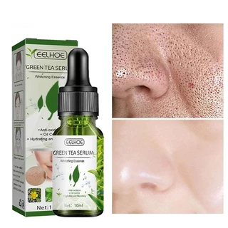 SERUM nhanh chóng loại bỏ mụn bọc, kem bôi mụn, phục hồi vết tích mụn và mụn, làm mờ thâm mụn