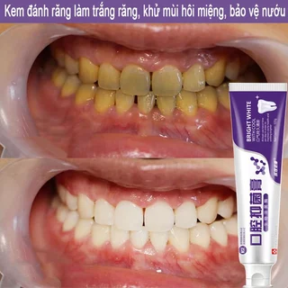 Kem đánh răng làm trắng và kháng khuẩn giúp răng trắng chắc khỏe, sạch khuẩn miệng, hơi thở thơm mát và bảo vệ nướu120g