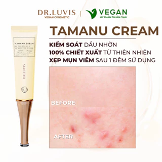 Kem giảm mụn Tamanu cream - giảm sưng, viêm hiệu quả sau 24 giờ