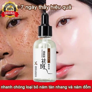 Tinh chất làm trắng sạch tàn nhang 30ml bỏ nám chất làm trắng da hiệu quả loại bỏ nám tàn nhang kem mờ nám làm trắng