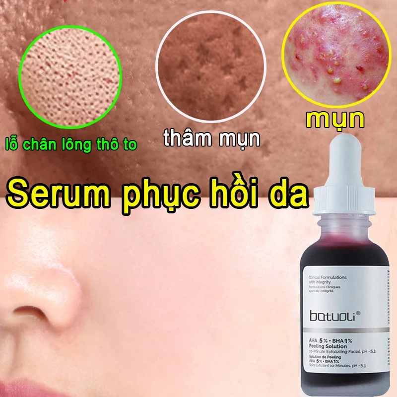 Serum se khít lỗ chân lông Serum trắng da 32ML làm sạch lớp biểu bì Lột mụn đầu đen Giảm mụn Se khít lỗ chân lông