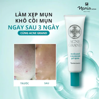 Gel chấm mụn Naris Acne Grand Medicated Concentrate Gel Spots 20ml