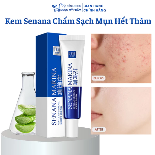 Kem Chấm Sạch Mụn Senana Đánh Bay Các Loại Mụn Sưng Mụn Cơm Mụn Ẩn Mụn Viêm Trên Da 20G