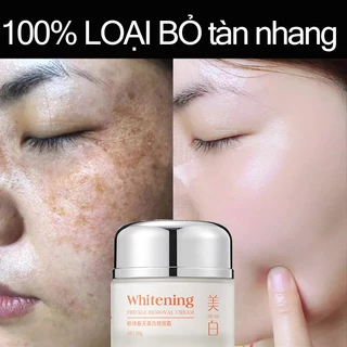 Kem xóa tàn nhang kem xóa nám 30g làm trắng da tinh chất  chất làm trắng da  mặt và loại bỏ nám làm sáng da chăm sóc