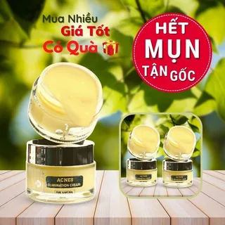 Kem Đặc Tri Mụn ẩn, Mụn đầu đen Doctor Care Acnes Elimination Cream