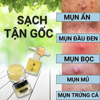 Bộ giảm mụn thâm Mụn ẩn, Mụn đầu đen Doctor Care (SERUM l + KEM )