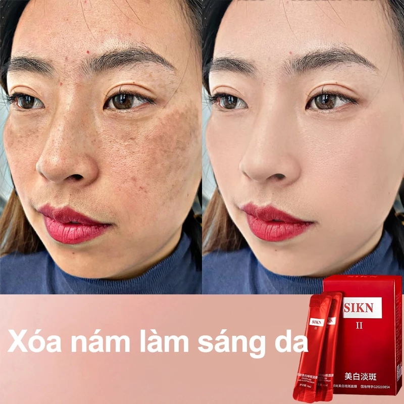 【SIKN】mặt nạ dưỡng trắng mờ nám  mặt nạ ngủ miễn rửa cấp ẩm làm sáng da 4ml*20