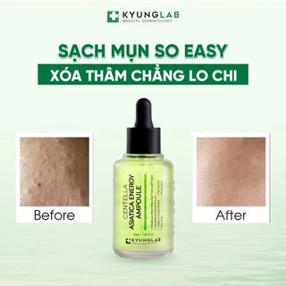 Serum ngừa mụn thâm Acnes Kyung Lab Centella Aisatica Ampoule 50ml kiềm dầu,làm dịu, giảm sưng mụn, ngừa thâm - Zuybeauy