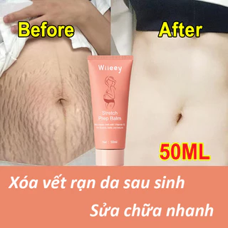 Vitamin E kem rạn da kem xóa nhăn kem phục hồi sau sinh 50ml dưỡng ẩm sâu phục hồi độ đàn hồi của da thành phần nhẹ