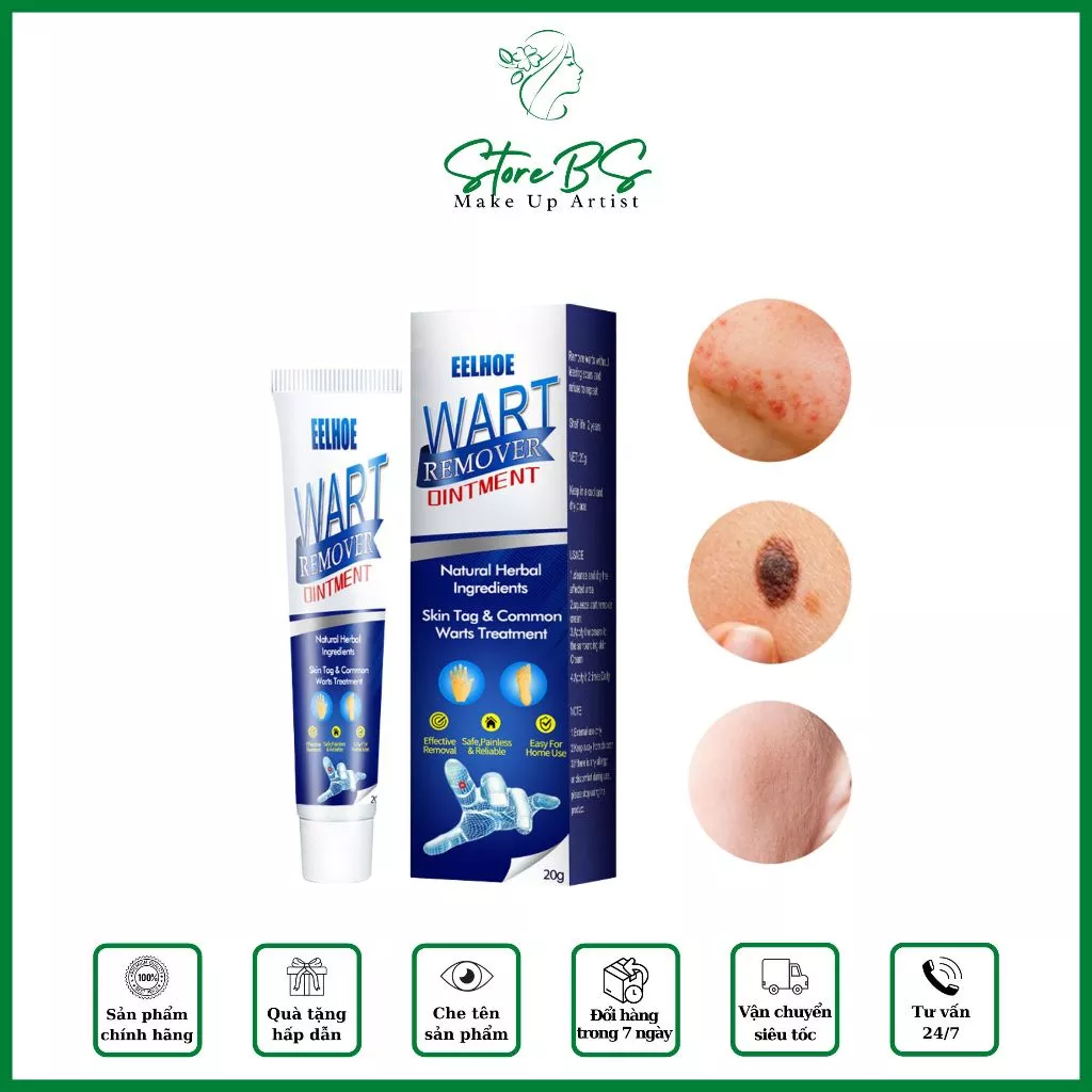 Kem xóa bỏ mụn cóc mụn thịt nốt ruồi trên da Wart Remover Ointment từ thảo dược thiên nhiên cao cấp không gây sẹo