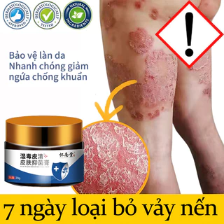 Kem bôi nấm ngứa 30ml Kem Bôi Vảy Nến,Viêm Da Cơ Địa,Chàm Da,Nấm Da,Hắc Lào,Á Sừng,Tiết Bã,Chàm Sữa,Kem Bôi Da