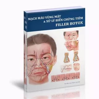 Mạch máu vùng mặt và xử lý biến chứng tiêm Filler B0t0x