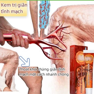 Kem suy giãn tĩnh mạch giúp giảm đau mỏi tê Varicose Veins Cream hỗ trợ suy giãn tĩnh mạch hiệu quả