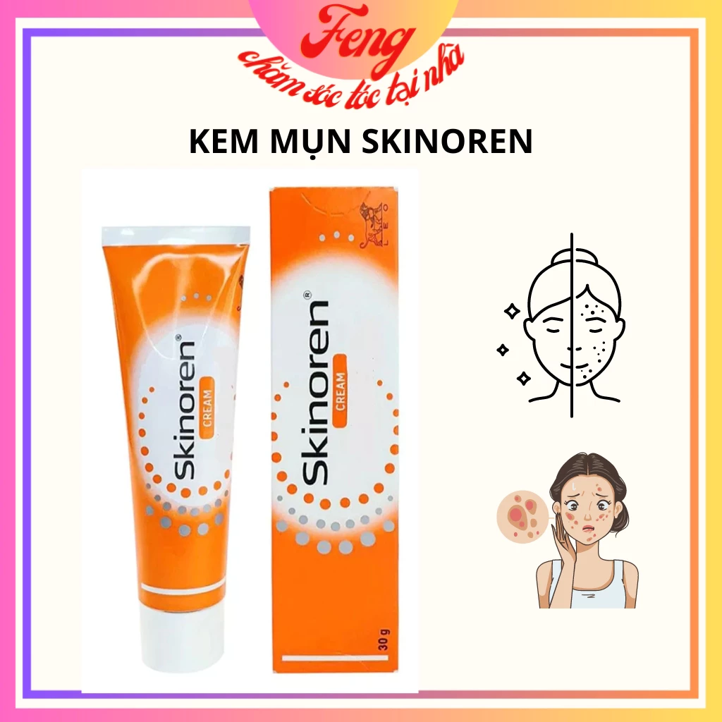 Kem bôi Skinoren 30g Ba Lan giảm mụn mờ thâm nám sạm da đặc biệt mụn đầu đen mụn trứng cá mụn ẩn