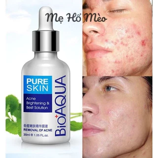 Serum ngừa mụn trứng cá Bioqua 30ml Mẹ Hổ Mèo