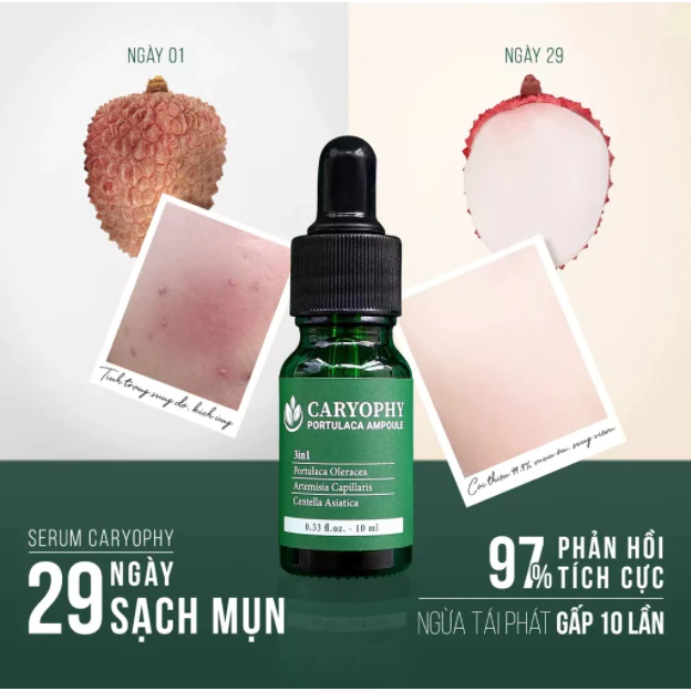 ❤  Serum làm lành mụn và thâm Caryophy Mụn Ẩn,Mụn Đầu Đen -Shopauth83