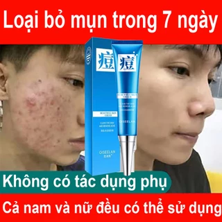 Kem chấm mụn cấp tốc,kem chấm mụn tận gốc,chóng loại bỏ mụn bọc,giảm thâm ngăn mụn tái phát, kem bôi mụn làm mờ thâm