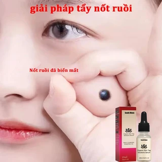 Dung DịCh TẩY NốT RuồI TẩY NốT RuồI ThuốC TẩY NốT RuồI Xoá NốT RuồI TẩY NốT RuồI ToàN ThâN LoạI Bỏ NốT RuồI HiệU Quả20ml