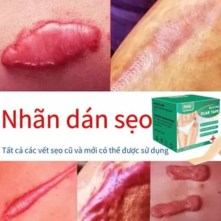 miếng dán sẹo lồi miếng dán che sẹo Miếng dán xóa mờ sẹo Miếng dán che khuyết điểm Miếng Dán trợ giảm sẹo  sẹo lõm