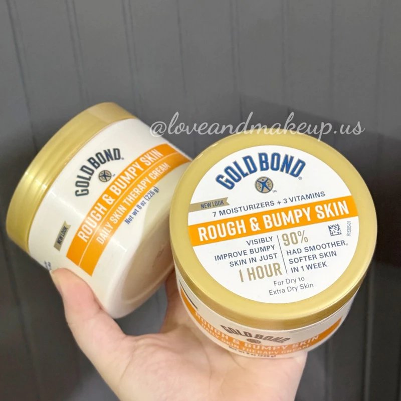 (AUTH CÓ BILL) Kem Dưỡng Da Gold Bond Ultimate Rough & Bumpy Skin Hộp Mới 226g