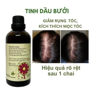 Xịt Bưởi Mọc Tóc Anu - Tinh Dầu Bưởi Giảm Rụng Tóc Kích Thích Mọc Tóc Hiệu Quả Sau 2 Tuần