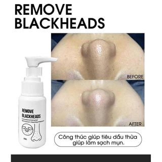 [ Hàng công Ty] Ủ mụn đầu đen Blackheads giảm mụn đầu đen sợi bã nhờn 50ml Dr Linh Hà