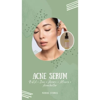 [Herbal Stories] Serum dành cho da mụn 20ml