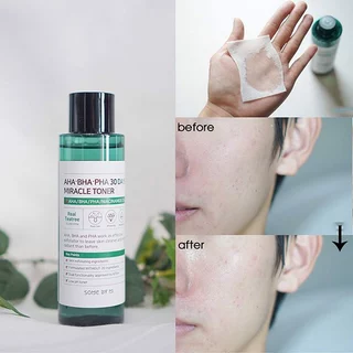 Nước hoa hồng SOME BY MI làm sạch da dầu mụn trong 30 ngày AHA -BHA -PHA 30 Days Miracle Toner 150ml