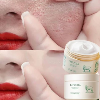 Kem dưỡng lanolin kem dưỡng ẩm chống nứt nẻ kem dưỡng ẩm lanolin kem dưỡng ẩm 140g kem dưỡng da tay nam nữ kem dưỡng ẩm