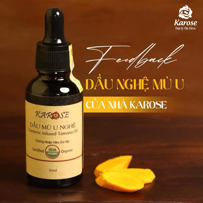 Dầu mù u nghệ Karose 30ml đẹp da cho mẹ an toàn cho con, tốt cho người bị viêm da cơ địa, vảy nến