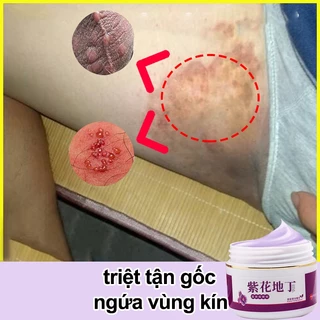 Kem giảm ngứa Triệt tận gốc Dùng bên ngoài loại bỏ vùng kín Nấm Ngứa hôi hám kháng khuẩn Chăm sóc vùng kín kem 30g