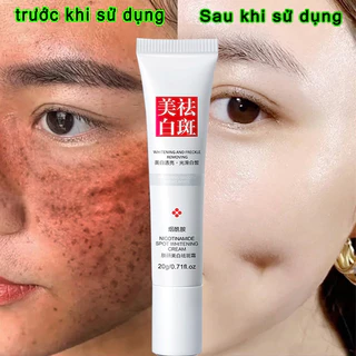 kem nám tàn nhang làm trắng da,niacinamide Loại bỏ các đốm đen sâu,loại bỏ nám và làm sáng da chăm sóc,dưỡng ẩm da