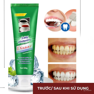 Kem Đánh Răng Dissaar US Thơm Miệng, Loại Bỏ Mảng Bám Trắng Sáng Giúp Bảo Vệ Lợi, Nướu Chắc Chân Răng