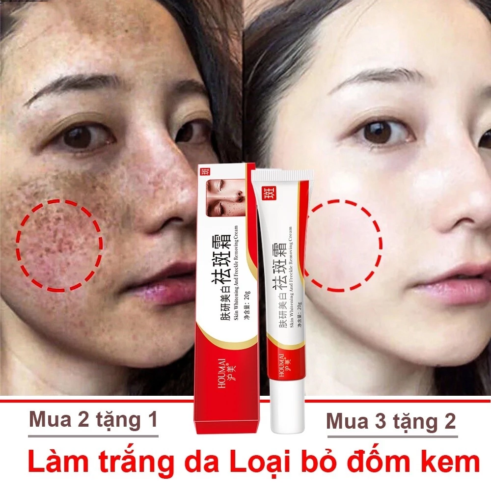 Loại bỏ tàn nhang, kem làm trắng da, sắc tố làm sáng da, phụ nữ, loại bỏ tàn nhang 20g Màu da không đều Chăm sóc da