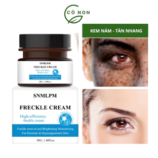 Kem nám tàn nhang  FRECKLE CREAM Kem xóa nám mờ nám tàn nhang đồi mồi dưỡng ẩm da phục hồi da chống lão hoá