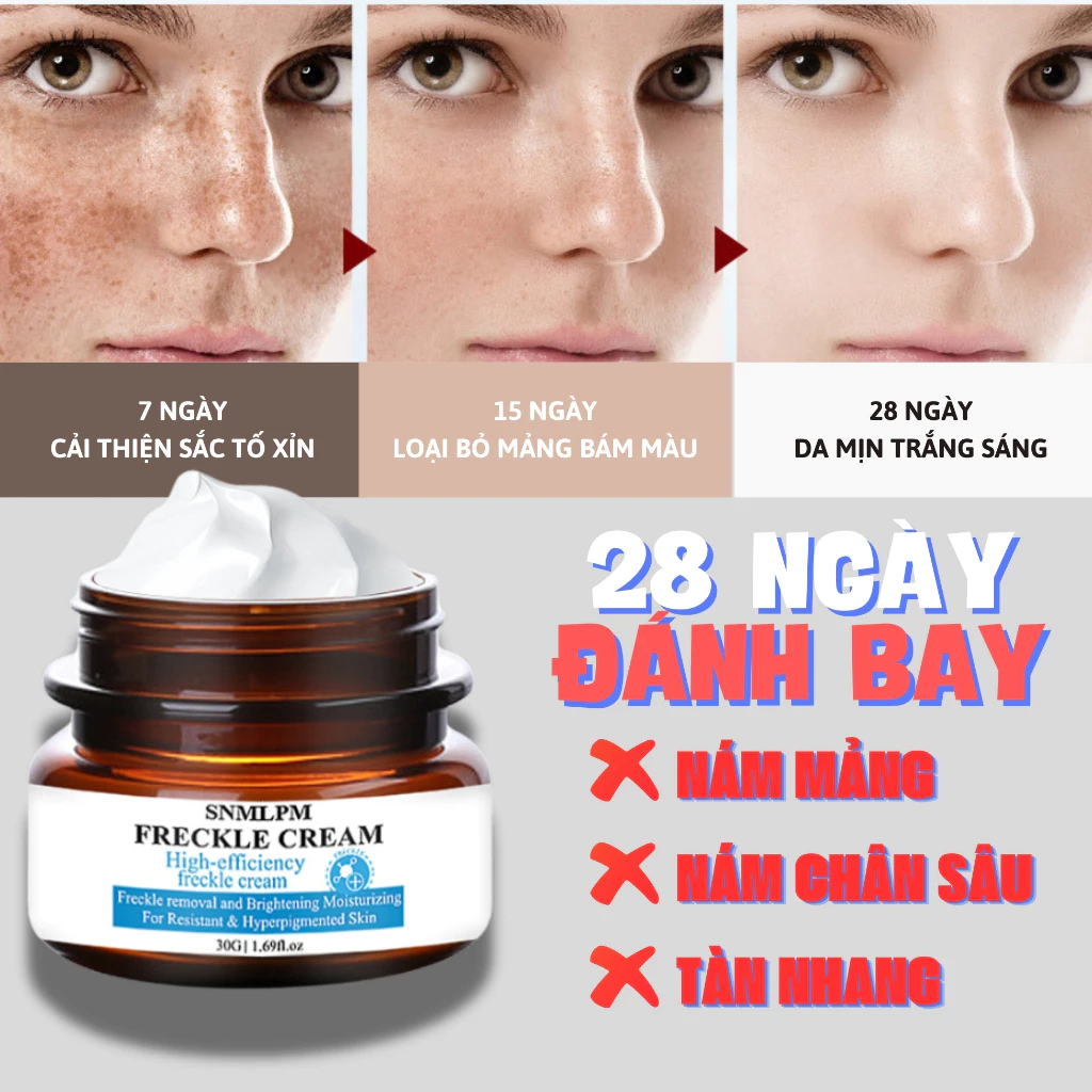 Kem nám tàn nhang ,Kem xóa nám FRECKLE CREAM mờ nám tàn nhang đồi mồi dưỡng ẩm da phục hồi da chống lão hoá