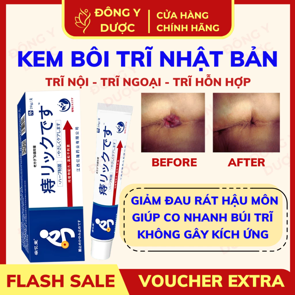 【CHÍNH HÃNG】Kem Bôi Hỗ Trợ Trĩ Nội Trĩ Ngoại Giảm Khó Chịu Hậu Môn NHẬT BẢN Làm Dịu, Làm Mát, Hỗ Trợ Cải Thiện Hiệu Quả