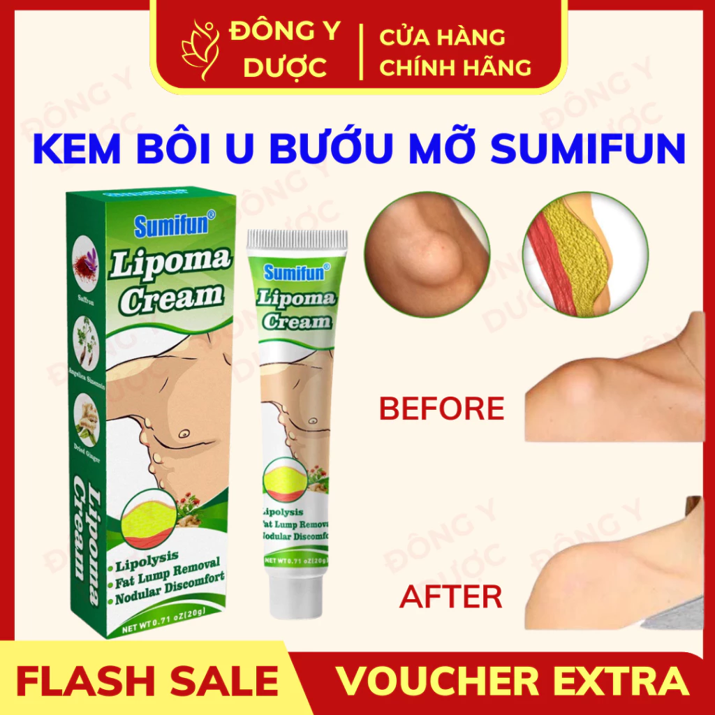 [CHÍNH HÃNG] Kem Bôi Tan U Mỡ Thảo Môc SUMIFUN Tan U Mỡ Lành Tính Lâu Năm, Đánh Tan U Bướu Mỡ 20g