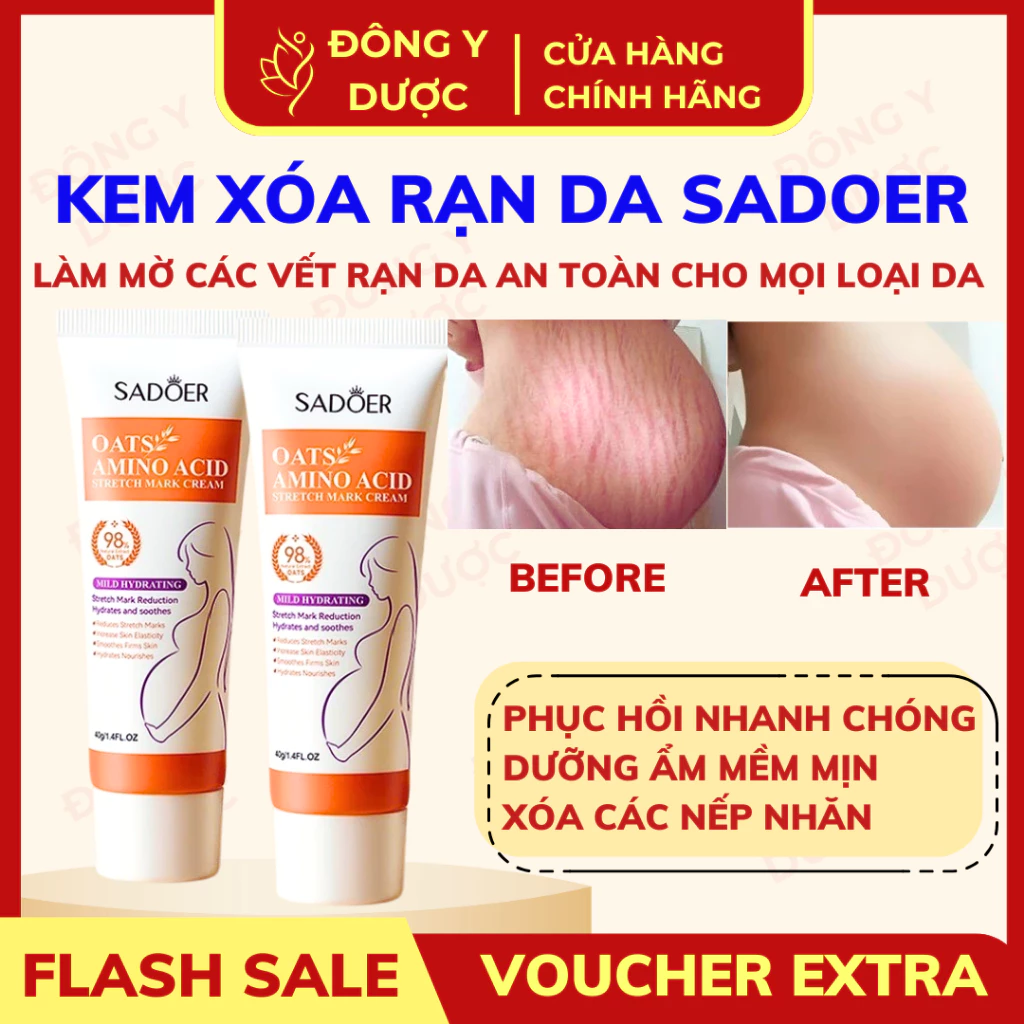 [CHÍNH HÃNG] Kem dưỡng da 40g làm mờ vết rạn, dưỡng ẩm, giúp da sáng đều màu, chăm sóc da săn chắc