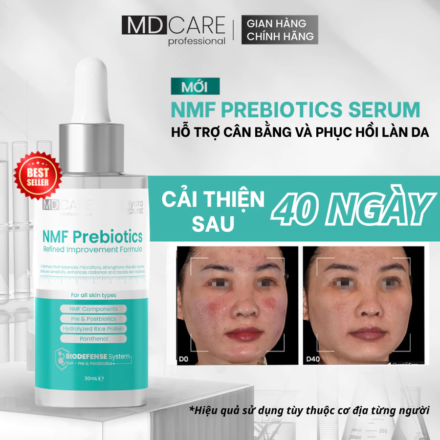 Serum NMF Prebiotics MD CARE 30ml Hỗ Trợ Cân Bằng Lợi Khuẩn Và Phục Hồi Hàng Rào Bảo Vệ Da