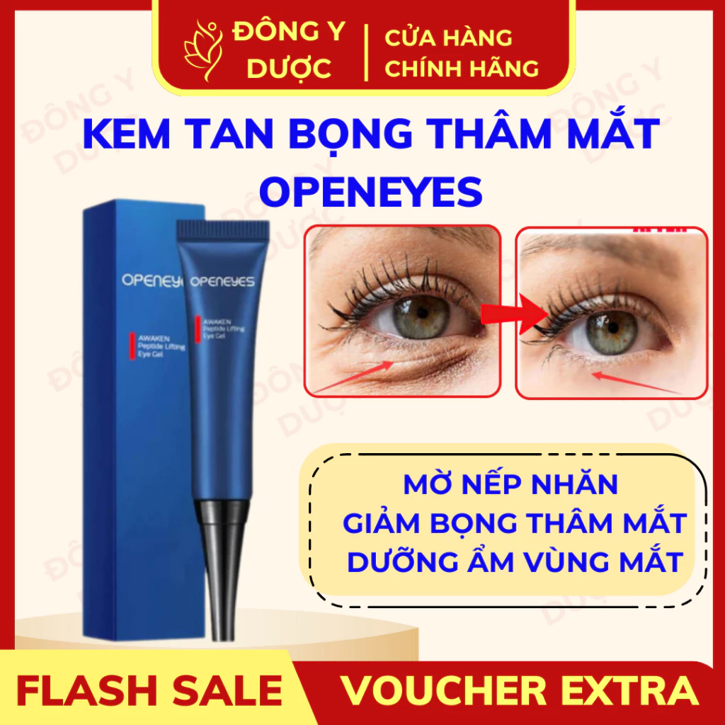 Kem Dưỡng Vùng Mắt OPENEYES - Hỗ Trợ Làm Mờ Quầng Thâm, Dưỡng Ẩm Giảm Bọng Mắt, Nếp Nhăn 15g