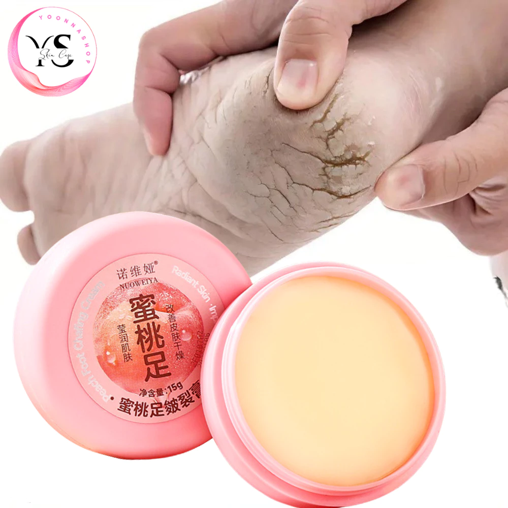 Kem Dưỡng Da Chân Chống Nứt Nẻ Nicor 15g – Hỗ Trợ Giảm Khô Ráp, Nứt Nẻ, Dưỡng Mềm Da Chân